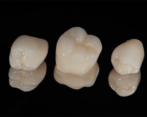 Three CEREC dental crowns sitting on black surface